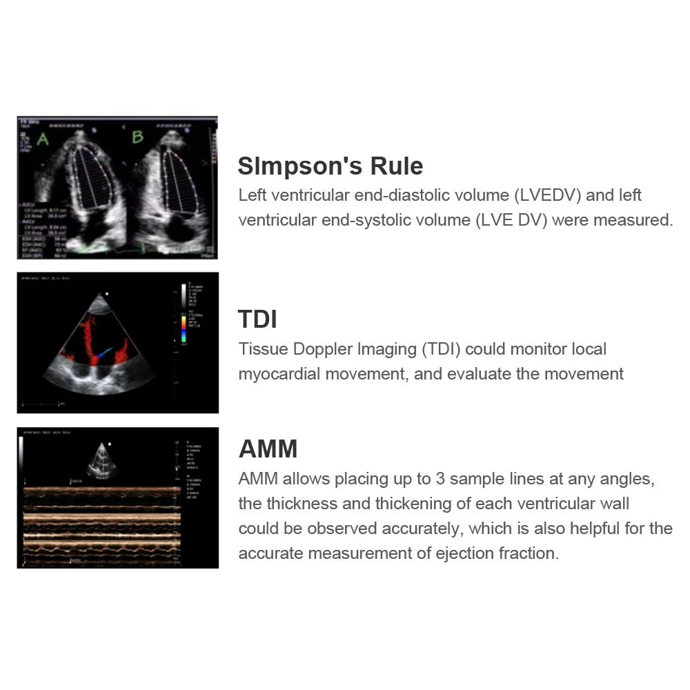 My-A031b Trolley Ecografo 3D 4D Farbdoppler-Ultraschallgerät, digitaler Herzultraschallscanner