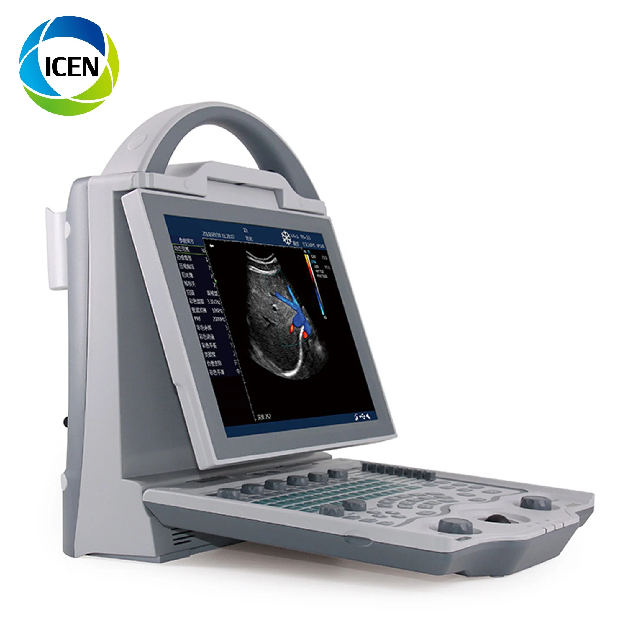 IN-A12 Medical Doppler portable digital clinical pregnancy diagnostic ultrasound scanner