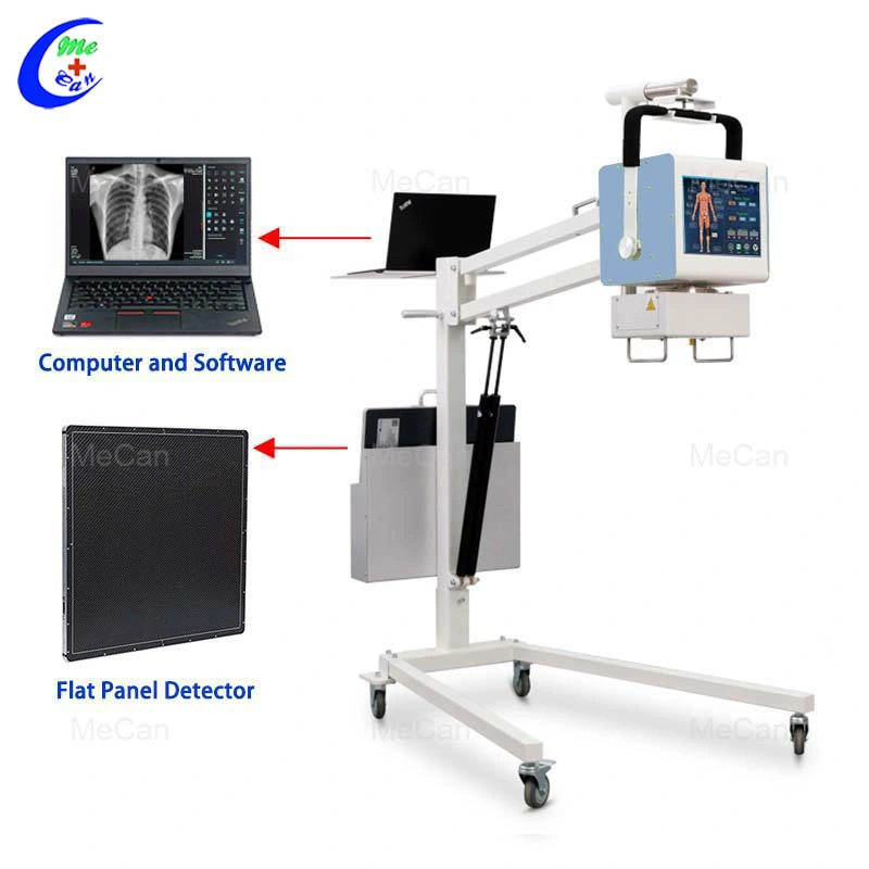 Radiography Chest Machine Other Radiology Equipment Radiographe Ray X Portable with Cheap Price