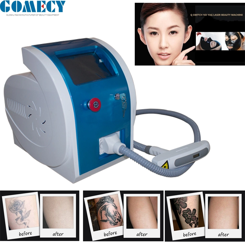 Q Switch ND YAG Laser Tattoo 1064nm und 532nm 755nm Sommersprossen Entfernung Haut Verjüngung Schönheit Laser-Maschine