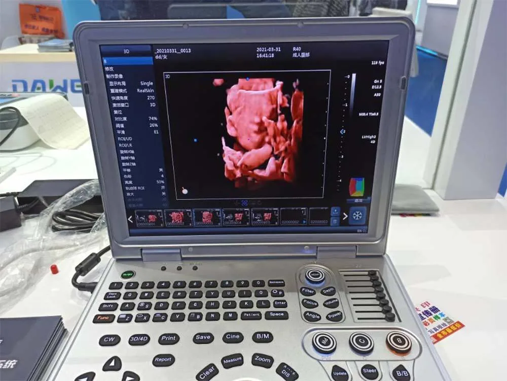 15 Inch LED Medical Display Able to Reverse It Above 160 Degree Portable Ultrasound Machine