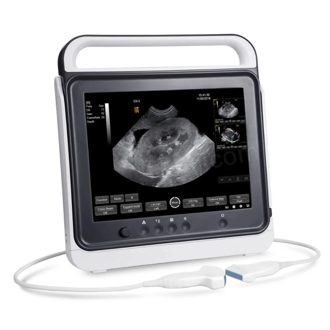 Fully-Featured Touch Animal Ultrasound System Handheld Veterinary Ultrasound Scanner for Equine Farm & Small Animals