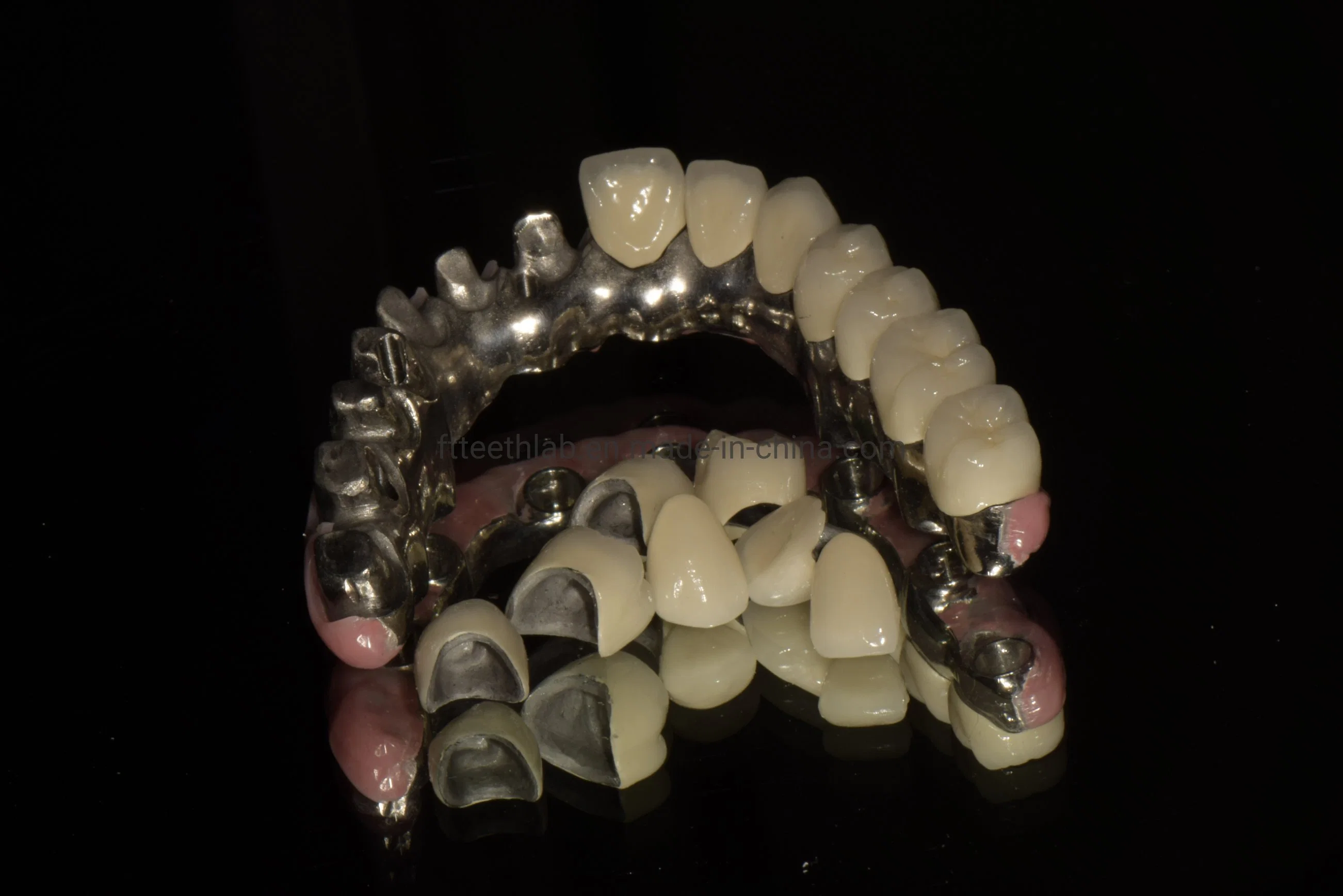 Full Arch Zirconia Screwed Implant Bridge