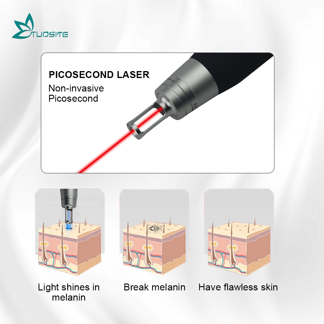 Pico punto de láser Q-Switched Eliminación Picosecond láser para el centro de belleza