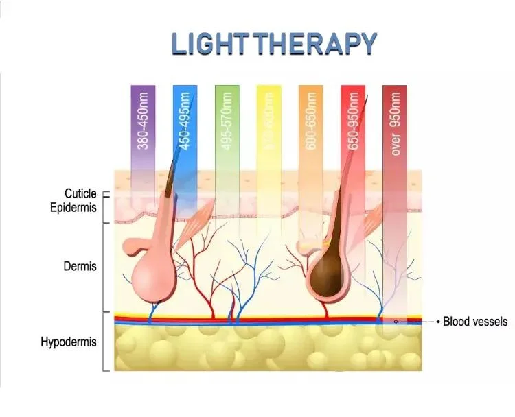 Multifunktionales DPL+ELight+SR HR +IPL + RF Haarentfernung Gefäßentfernung IPL DPL Skin Rejuvenation Machine