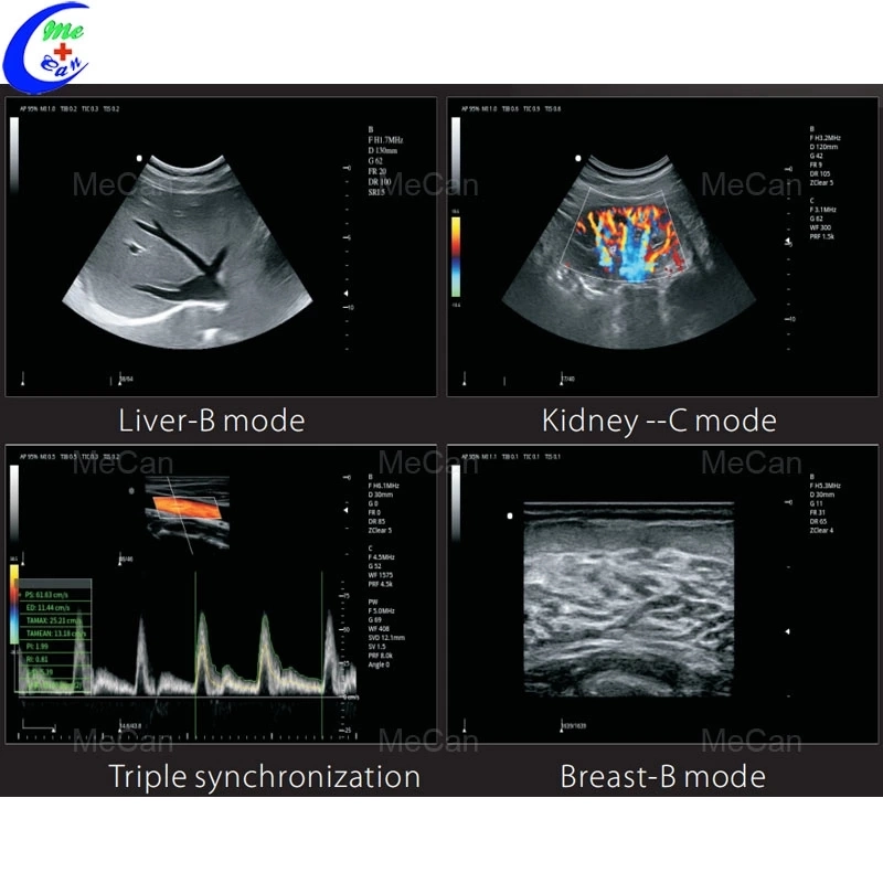 Antes de Cardiología Echographe Echo totalmente digital portátil de ultrasonido escáner Doppler Color con buen precio.