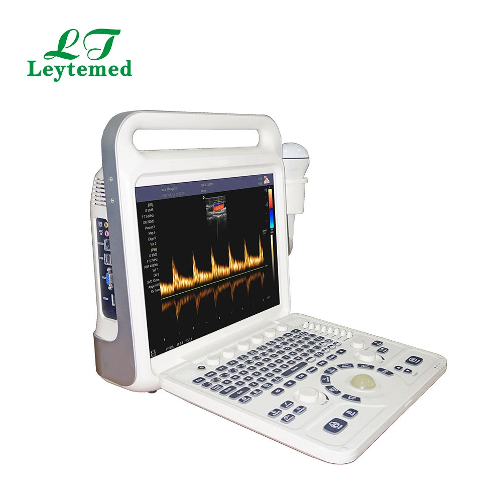 Ltub63 Urology Cardiac Gynecology Obstetric USG Color Doppler 4D Ultrasound-Machine