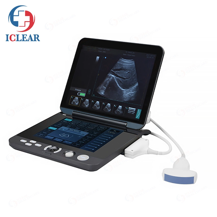 Portable Full-Digital Ultrasound System Notebook B/W Medical Ultrasound Scanner