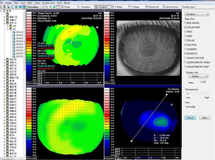 Topography Equipment Corneal Topographer