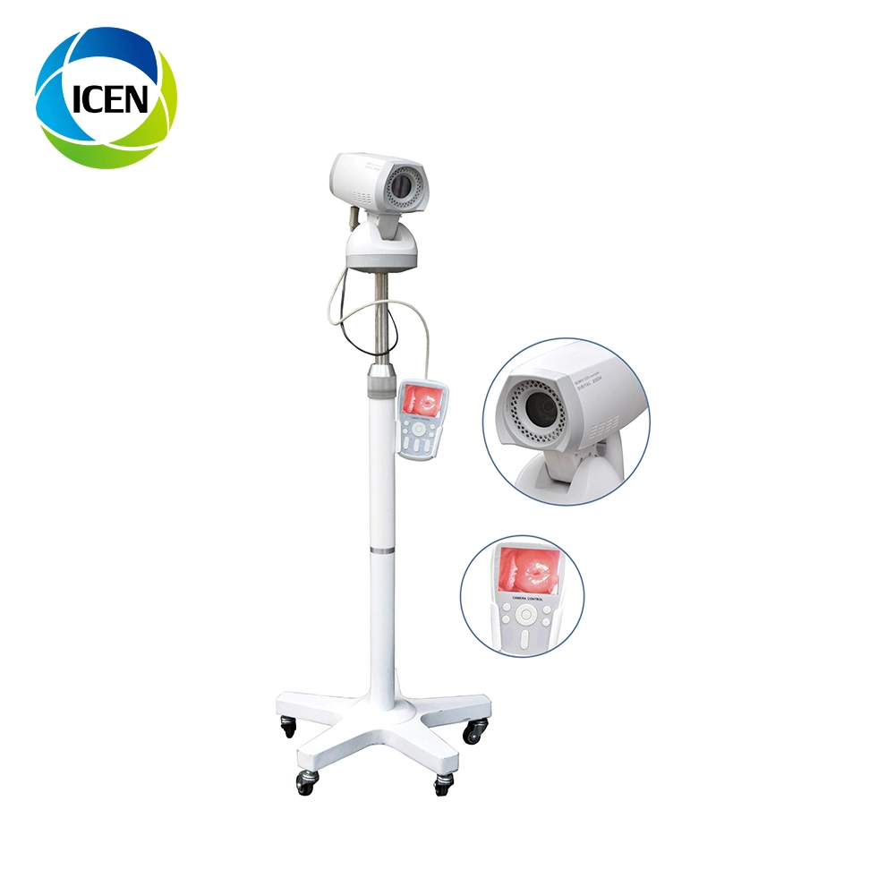 In-G9800A Medical Equipment Colposcope Digital Imaging System Specifications White LED (مواصفات نظام التصوير الرقمي في G9800A) مصدر الضوء لمنظار كولبوسكوب