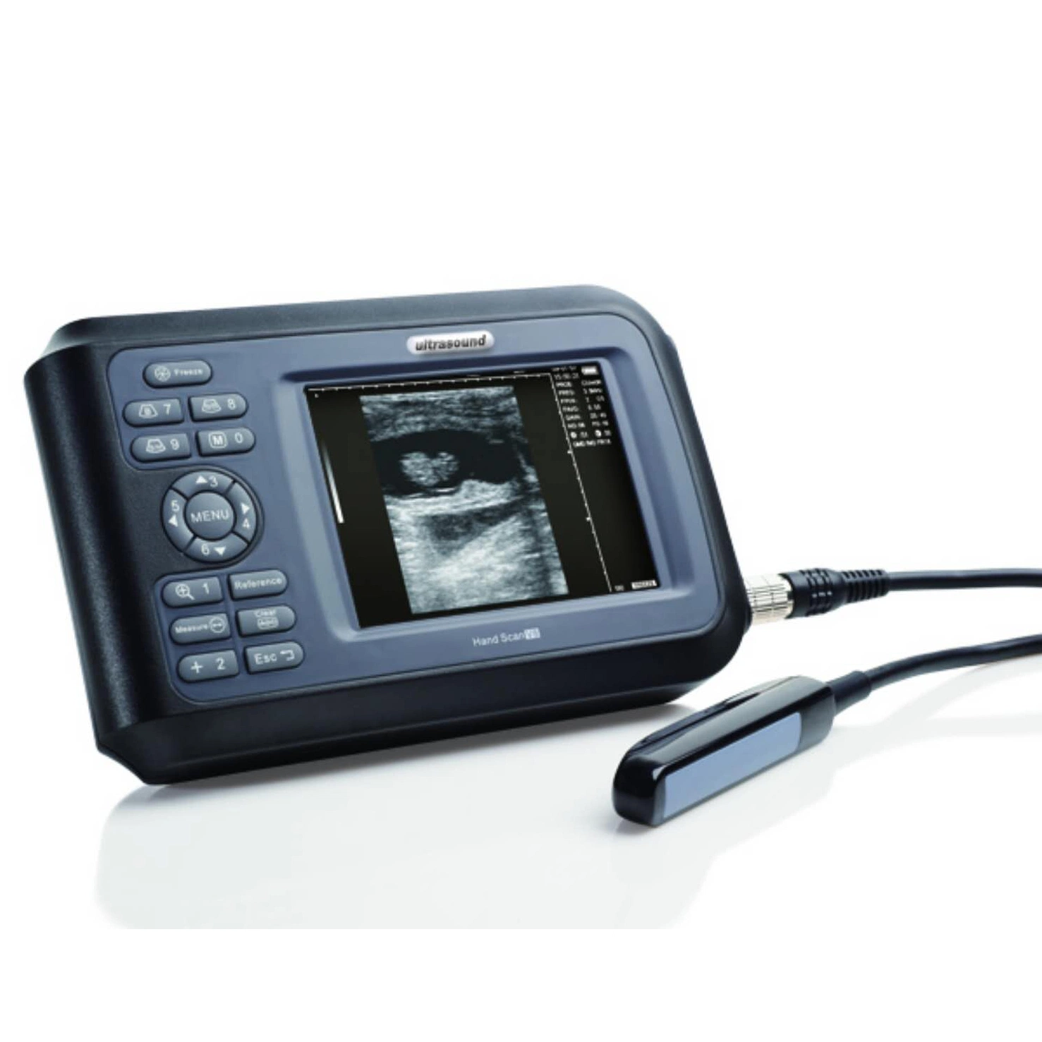 Hand Held Vet Ultrasound Scanner Veterinary Portable Equipment Livestock Ultrasound Machine