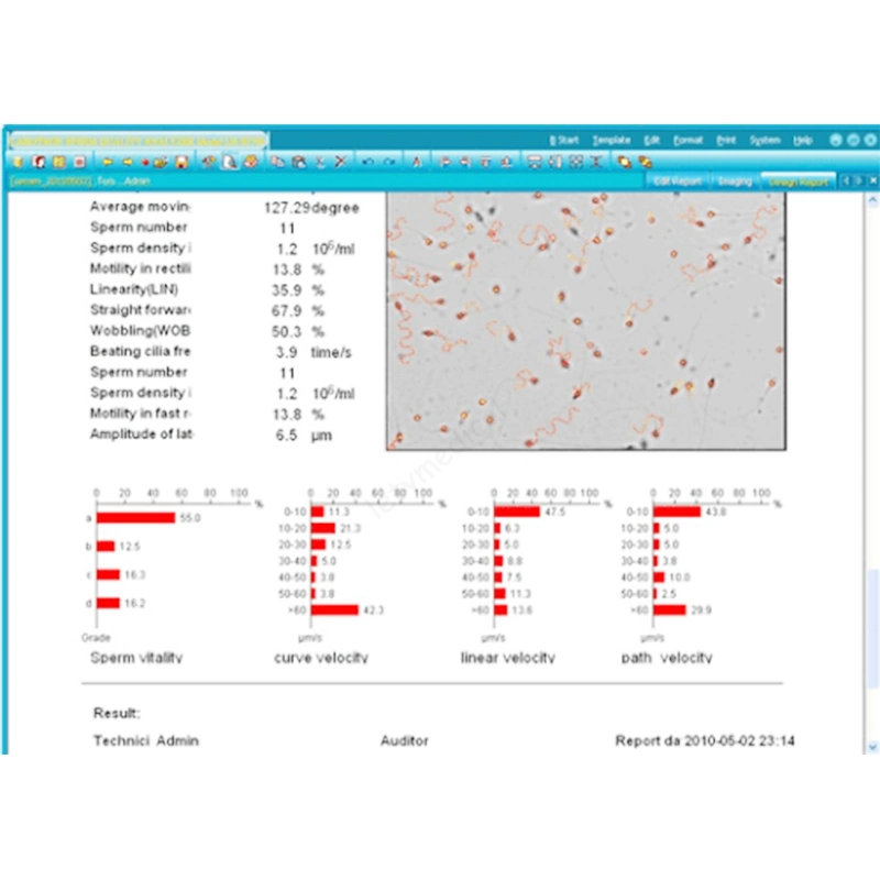 Sw-3703 Sperm Quality Analyzer Sperm Quality Microscope Andrology Workstation