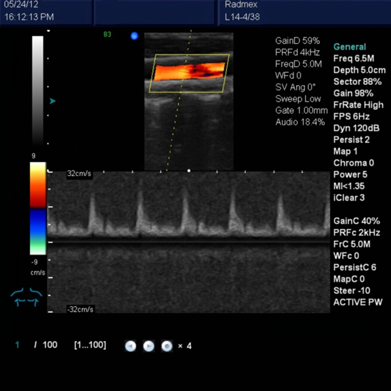 My-A027 3D Full Digital Color Doppler Ultrasound