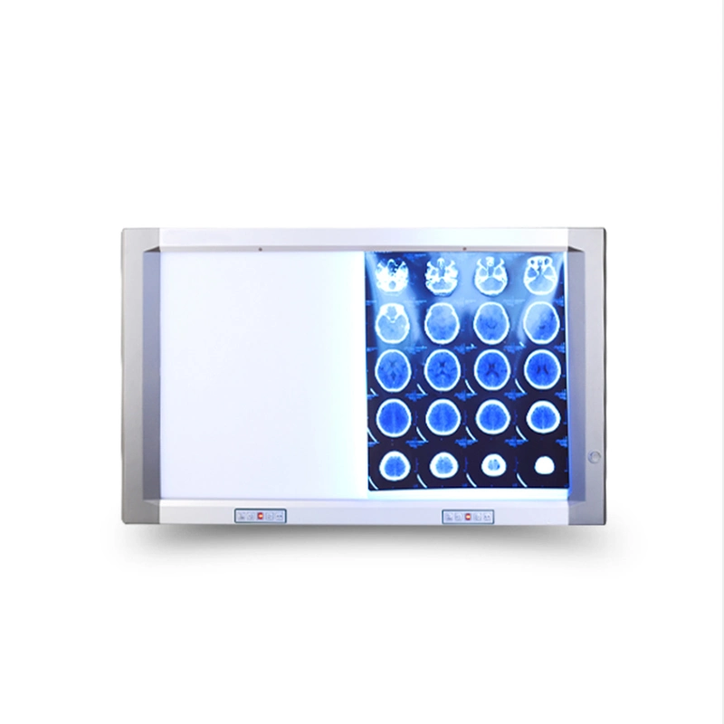 Super Thin Portable Double Panel X Ray LED Medical Film Viewer