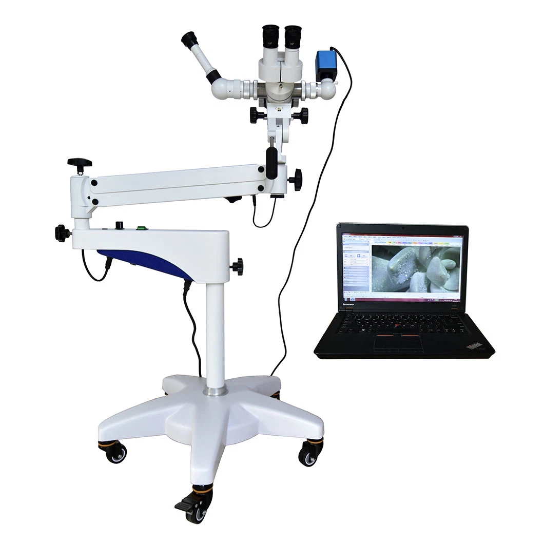 High Resolution Camera Video Vaginal Operation Microscope with 10W LED Lamp