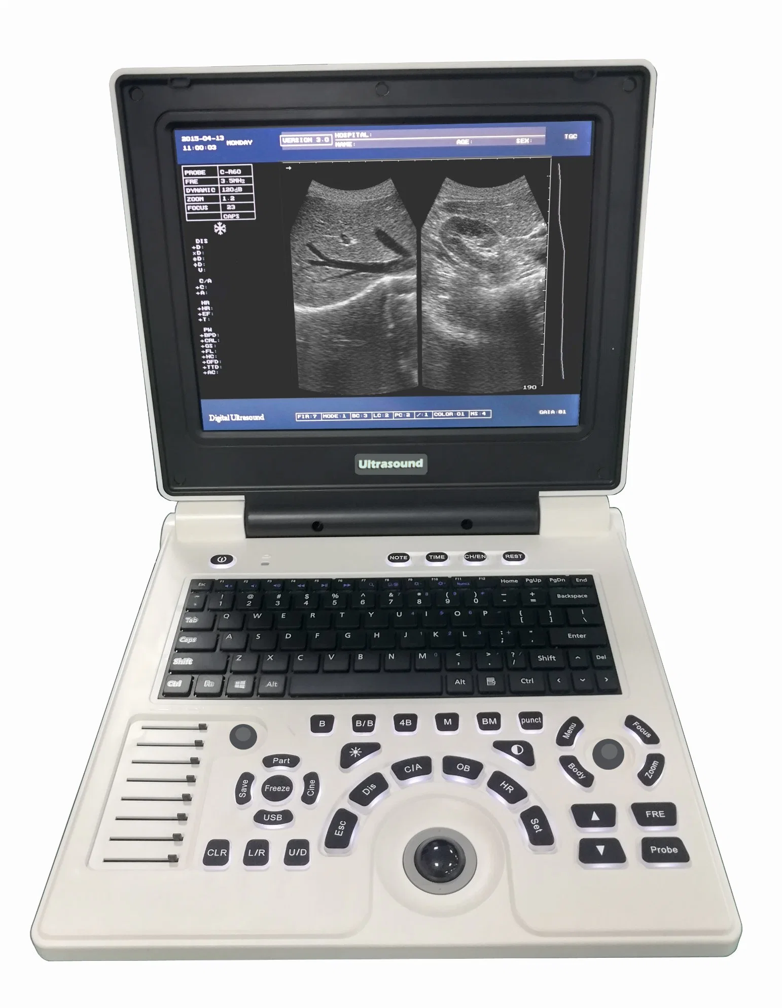 Medizinische Diagnosemeitsgeräte S/W Tragbarer Ultraschallscanner Krankenhausausrüstung