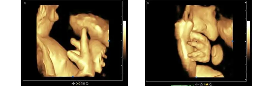 Ecografía Doppler Color Digital completa la máquina con el carro (THR-USC900)