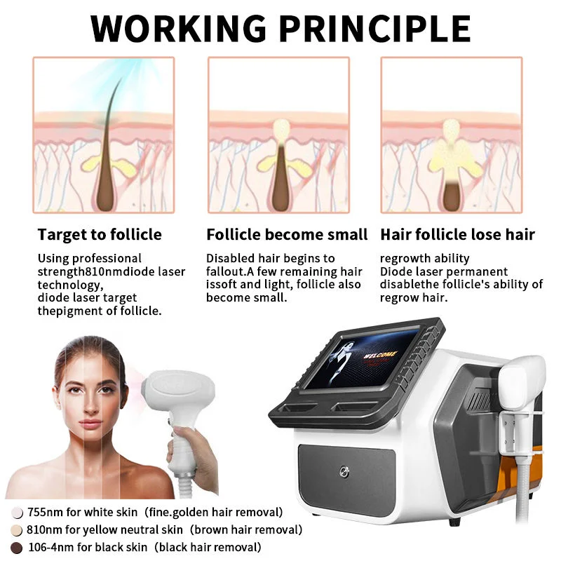 Huanshi Elegant Shape Portable 810nm Diodelaser Hair Removal Machine Beauty Salon Equipment Laser All Skin Type