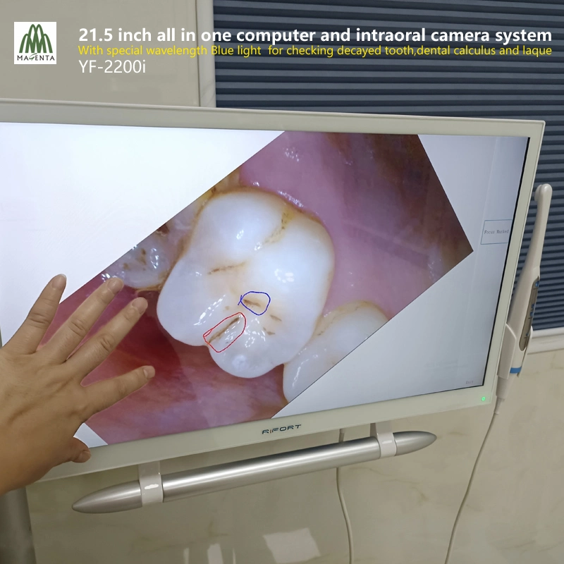 Configuração de alta 21,5" de tela sensível ao toque Windows 10 e Oral Dentária Unidade de câmara com luz azul para dentes cariados/cálculo matemático e placas