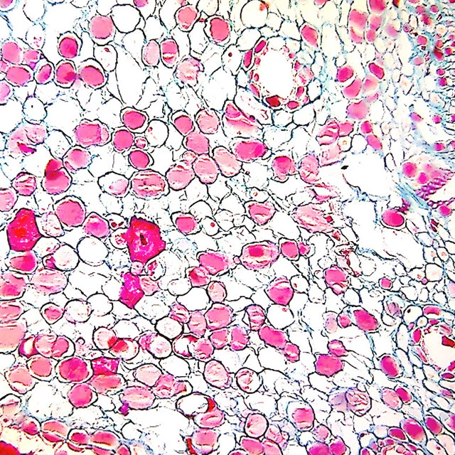 BestScope BS-2046T LED NA1,25 Investigación médica microscopio biológico trinocular