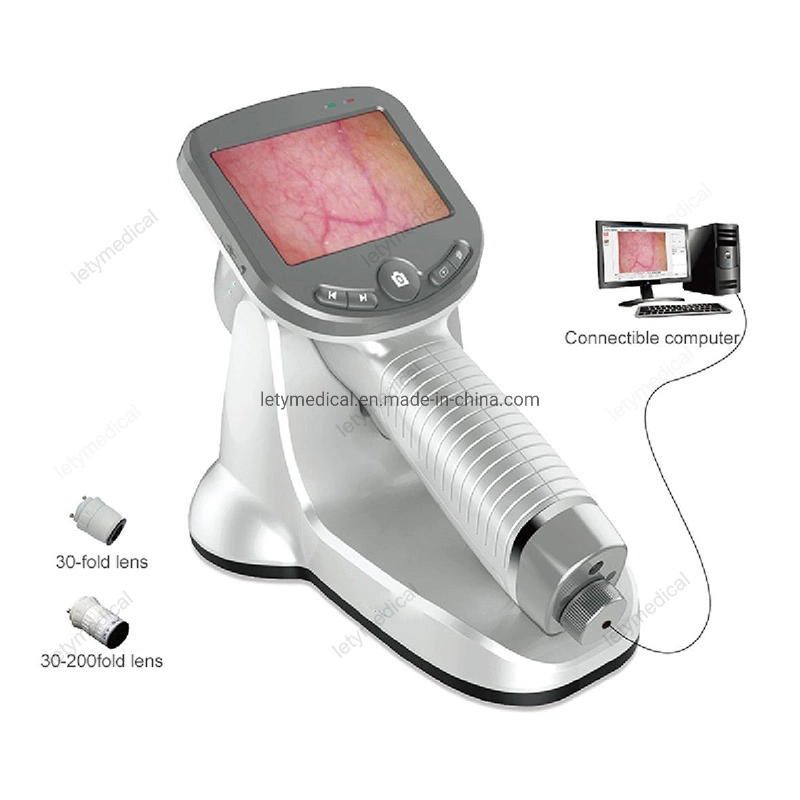 Ordinateur de poche Dermatoscope Microscope électronique portable Test cutané Dermatoscope Dermoscope portable de l'analyseur de la machine