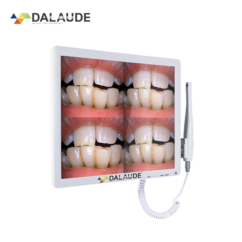 Dalaude Medical 5-50mm Focusing Scope Intra Oral Camera Multi-Pictures Video