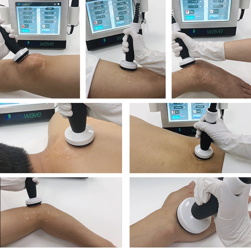 2 en 1 Terapia corporal dispositivo de alivio del dolor físico Ultra Rehabilitación de ultrasonido de ondas máquina de fisioterapia ultrasónica Equipo de Ultraswave