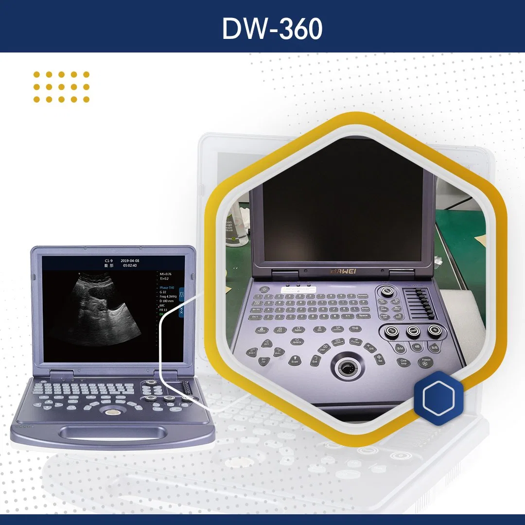 Appareil de diagnostic portable à ultrasons noir et blanc de veille ultra-longue durée abdominal Obstétrique