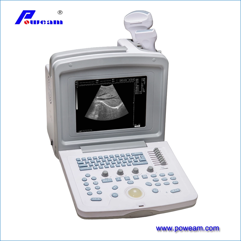 CE ISO Approved Good Quality Hospital Euipment Portable Full Digital Ultrasound (WHYC30P)