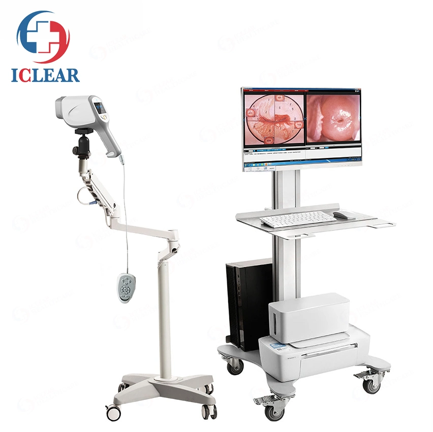 Sony CCD 2.1 Million Medical Digital HD Video Gynecology Colposcopy Equipment