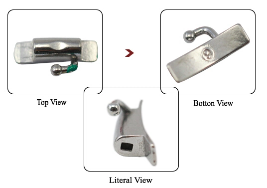 Orthodontic Molar Band with Convertible Roth Buccal Tube