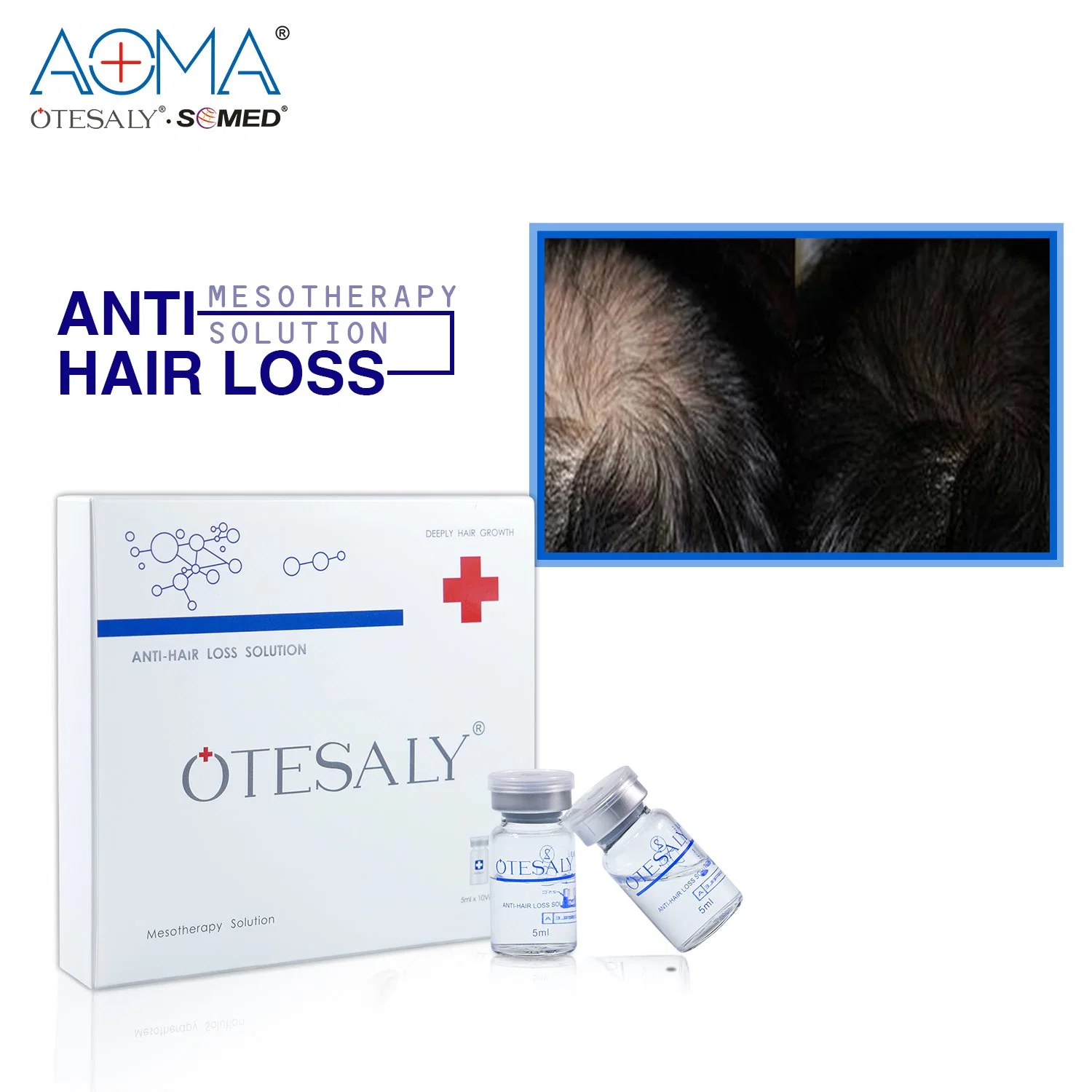 Haircare crecimiento del cabello Inyección Otesaly Anti pérdida del cabello Mesoterapia solución