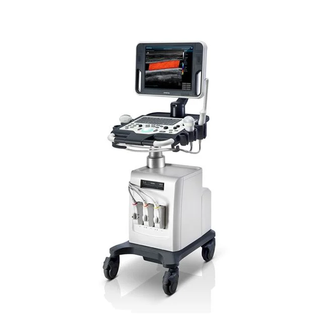 Mindray DC-30 Siterite Smart Diagnostic Trolley Ultrasound Equipment with Exceptional Capabilities