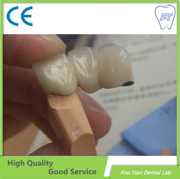 Dental Zirconium Bridges From China Dental Lab