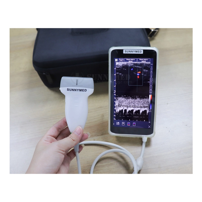 Sy-AC048 Portable Color Ultrasound Machine USB Ultrasound Device Digital Color