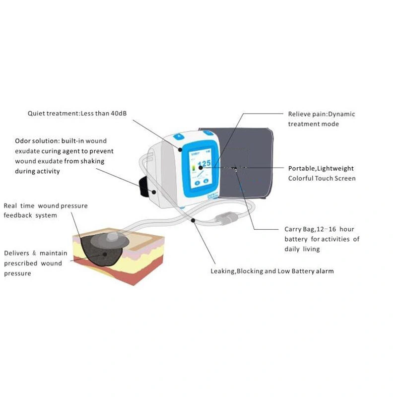 BluEnjoy NPWT Wound Care Drainage Kit de Apósito de espuma PU Desbridamiento solución para pies diabéticos dispositivo de TPN