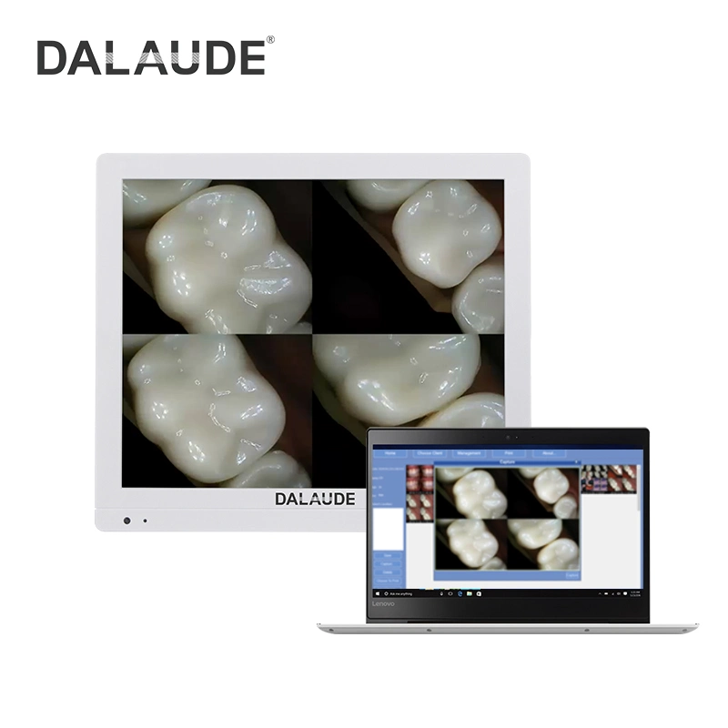 Dental Camera with WiFi Wireless Transfer Pictures and Metal Arm