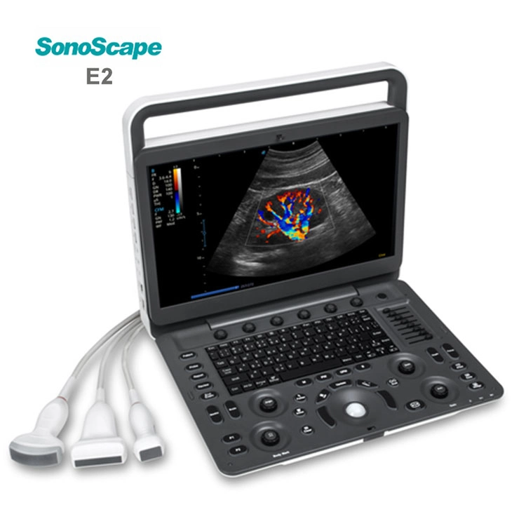 2023 Medsinglong медицинской ультразвуковой инструмент Msk акушерских/гинекологических исследований 3D 4D 5D-E2 Sonoscape ультразвукового сканера портативных ультразвуковых систем