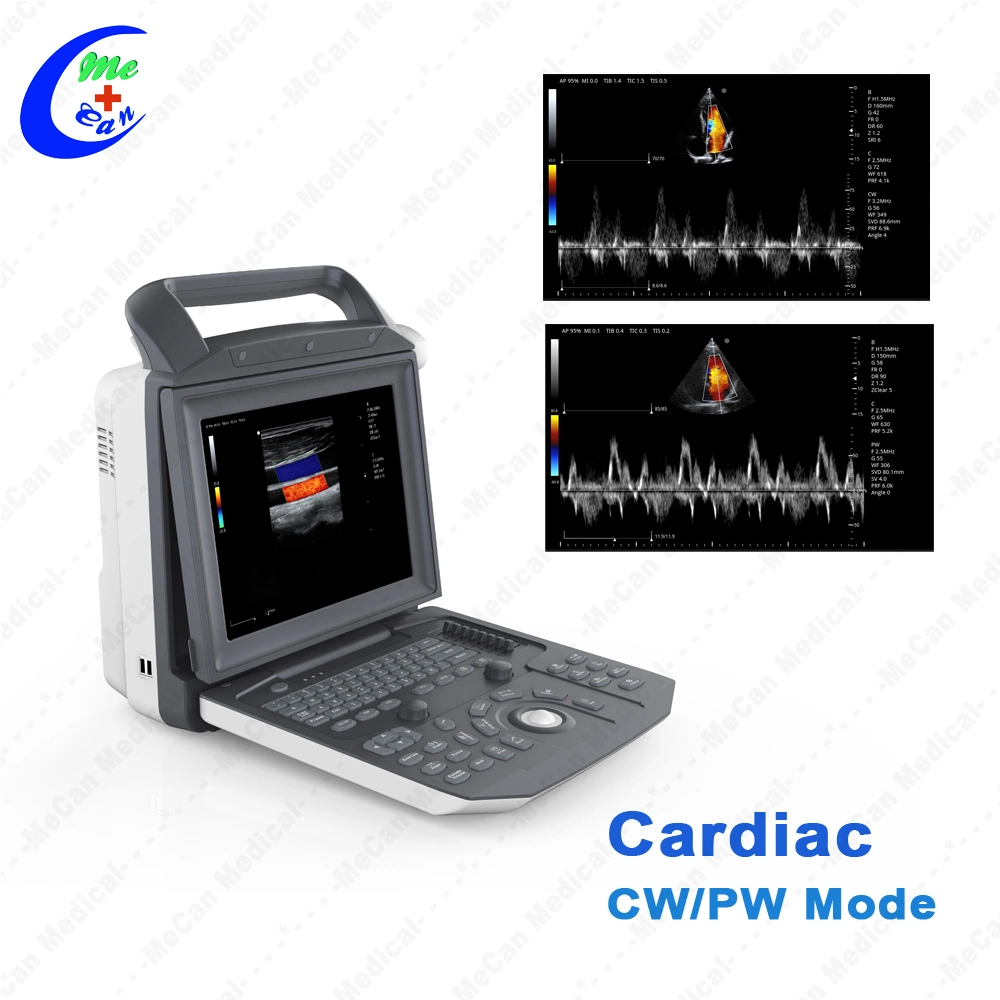 Móviles portátiles totalmente digital eco cardiaca ecocardiografía ecografía Doppler Color portátil aparato de ultrasonido para el Embarazo