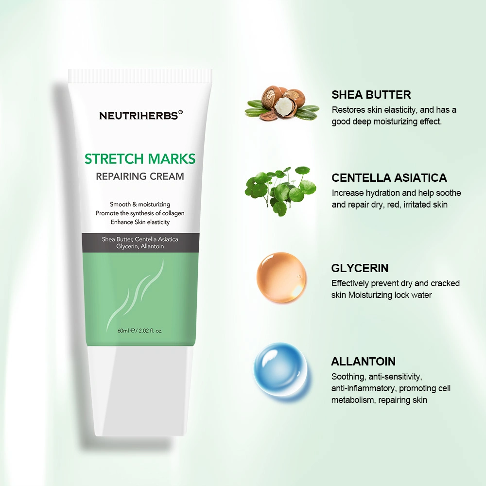 Private Label Remove Stretch Marks Repairing Smooothing Skin Stretch Mark Cream