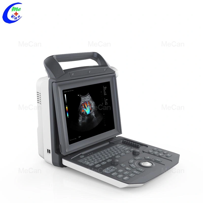 Advanced Echo Cardiology Full Digital Echographe Portable Color Doppler Ultrasound Scanner zu einem guten Preis