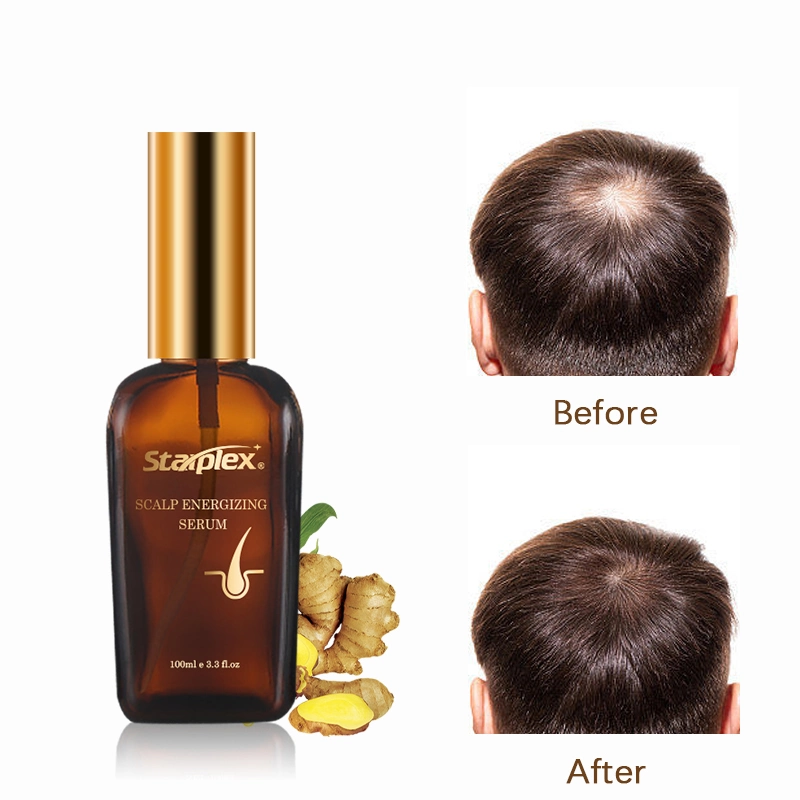 Crecer el cabello tratamiento personalizado de espesamiento de Jengibre Orgánico Aceite de suero de crecimiento del cabello Herbal