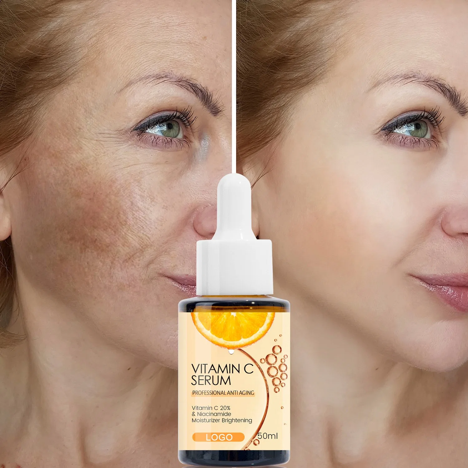 Beleza cosméticos cuidados da pele brigando Anti rugas envelhecimento niacinamida vitamina C soro