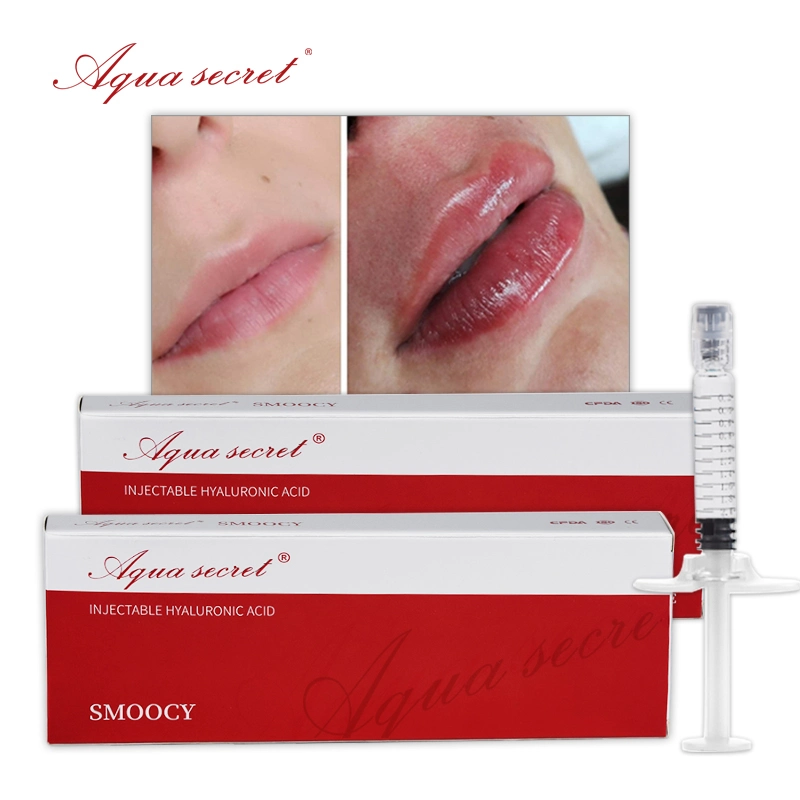 Aqua Secret Ha 1ml 2ml Dermal Filler Injection Cross Linked Hyaluronsäure für die Gesichtslippen