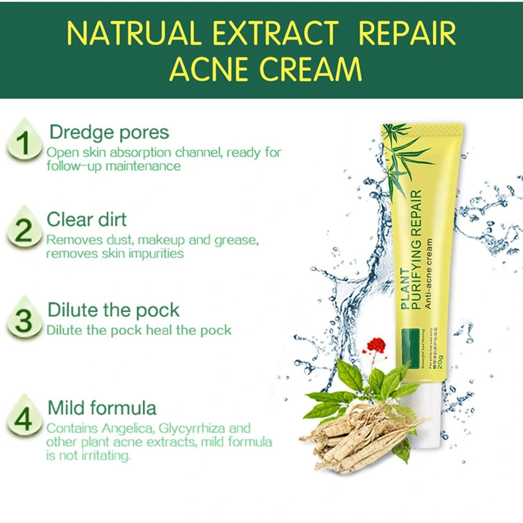 Natural Plant Extract Acne Spot Treatment Acne Scar Removal Cream Skin Care