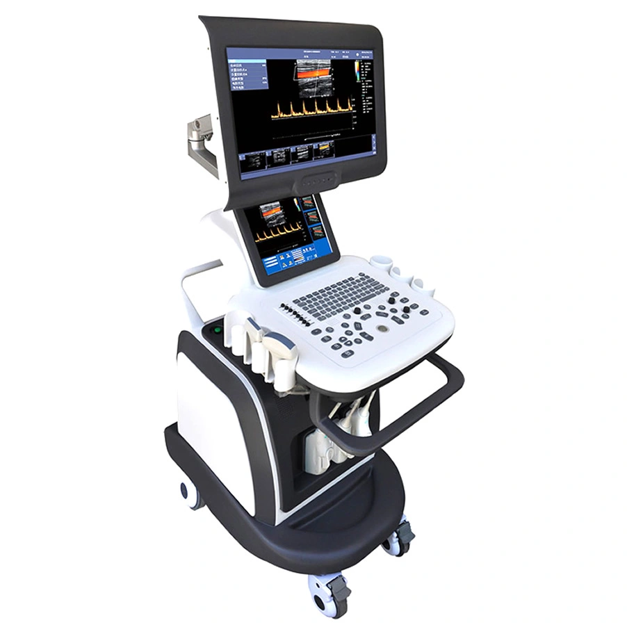 Color Doppler Trolley Ultrasound Machine Price