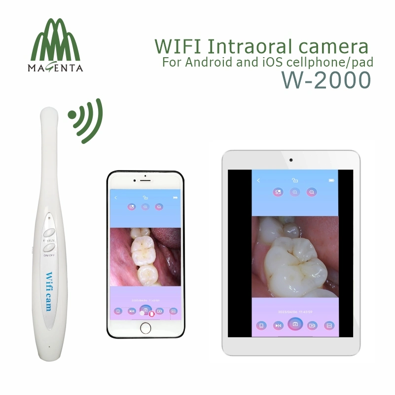 La última venta caliente Wireless WiFi Cámara Intraoral W1000