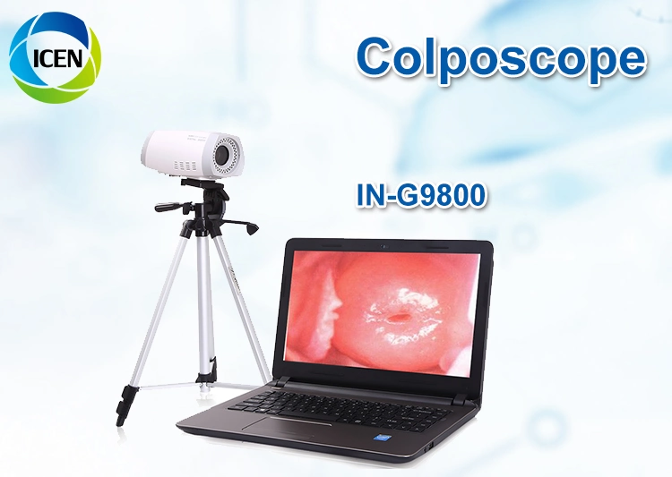 In-G9800 Medical Hospital Digital Video Colposcope for vagin Gynécologie