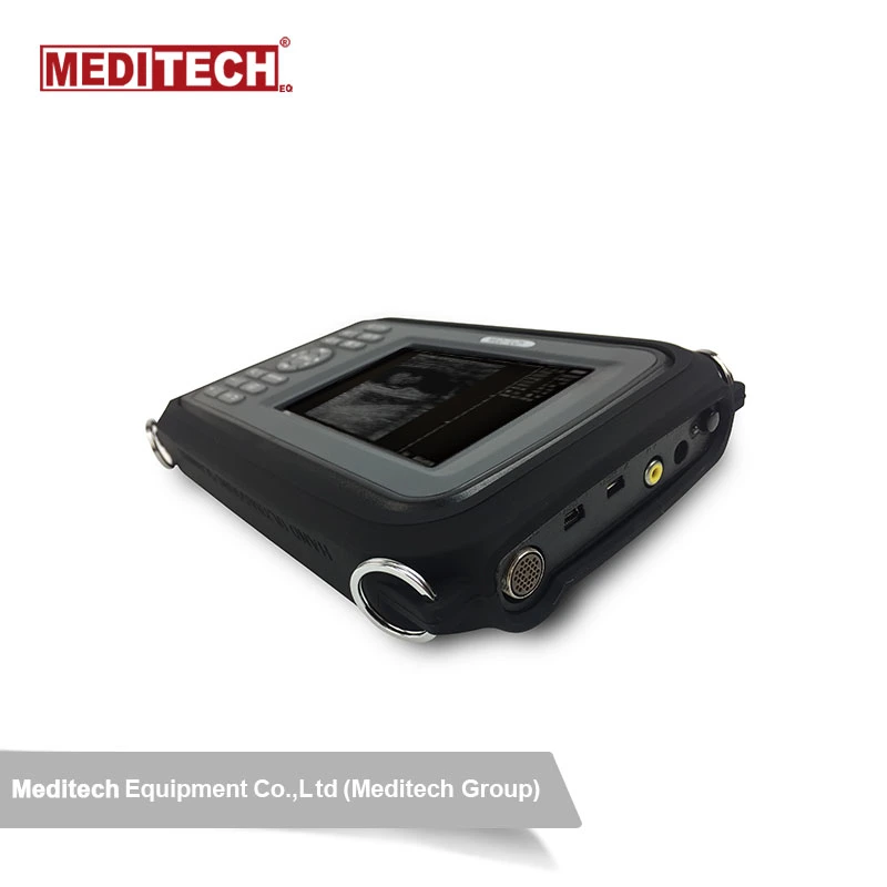 MEDITECH China Medical Diagnostic محمول رقمي الموجات فوق الصوتية الماسح الضوئي Sono R