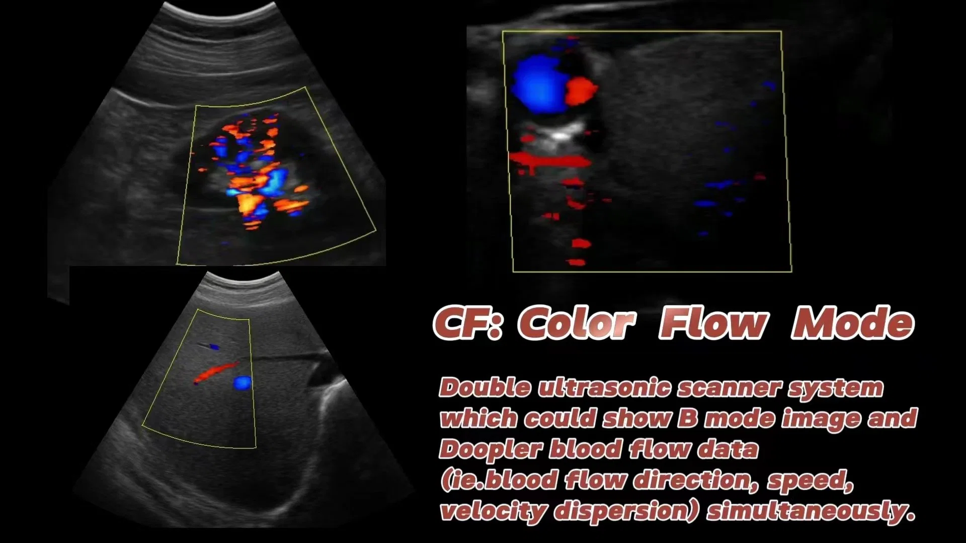 Poupler Trolley Color Douppler Ultrasound Scanner